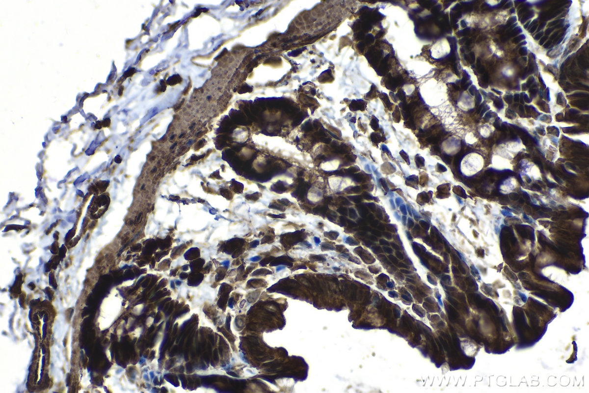 Immunohistochemical analysis of paraffin-embedded rat colon tissue slide using KHC1177 (TRIM21 IHC Kit).