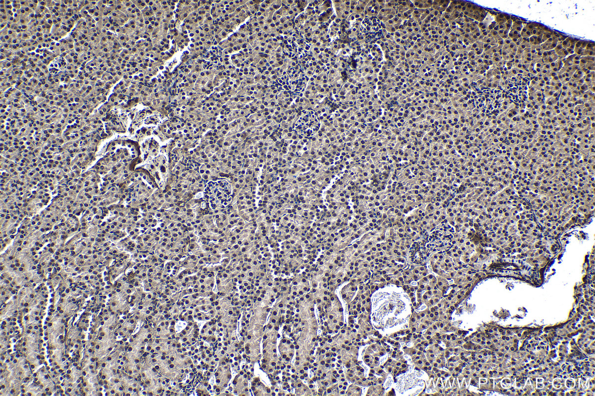 Immunohistochemical analysis of paraffin-embedded mouse kidney tissue slide using KHC1176 (TRIM24 IHC Kit).