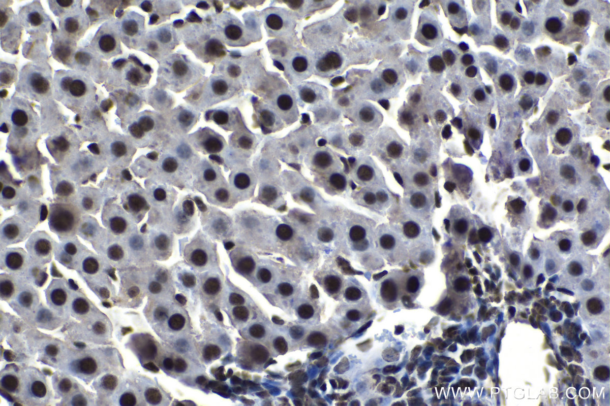 Immunohistochemical analysis of paraffin-embedded rat liver tissue slide using KHC1176 (TRIM24 IHC Kit).