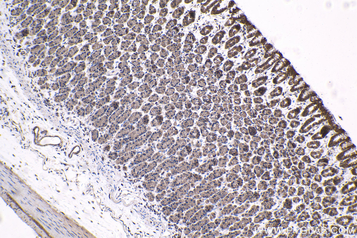 Immunohistochemical analysis of paraffin-embedded rat stomach tissue slide using KHC1532 (TRIM27 IHC Kit).