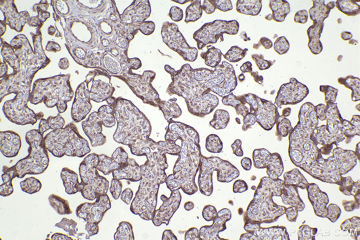 Immunohistochemical analysis of paraffin-embedded human placenta tissue slide using KHC2446 (TRIM29 IHC Kit).