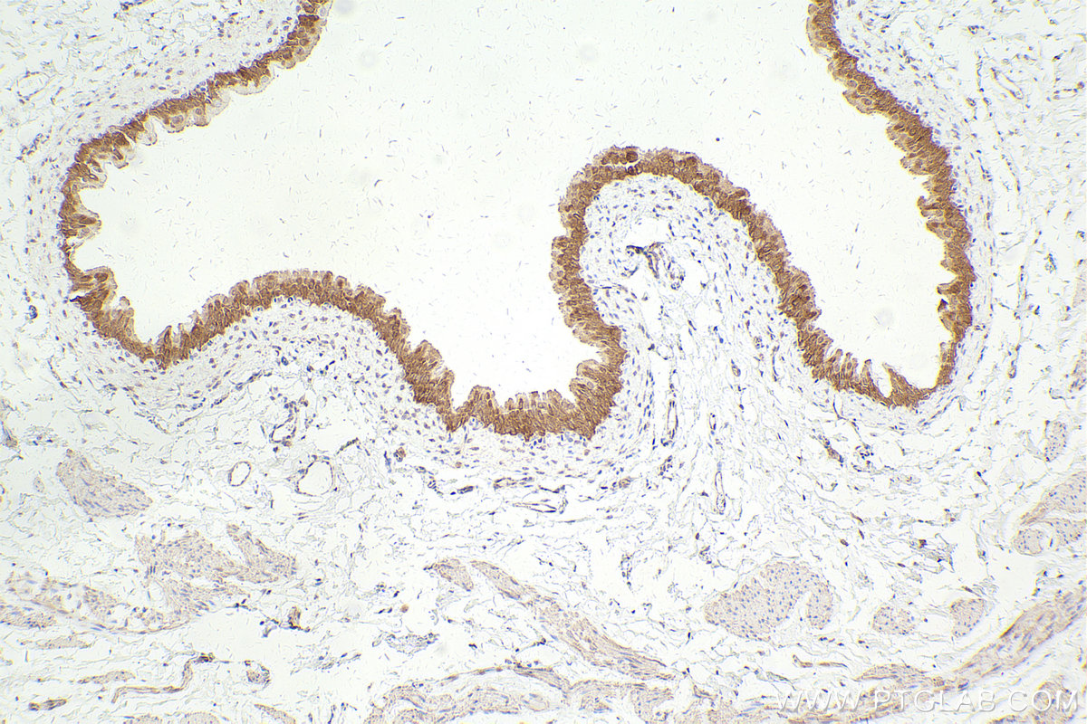 Immunohistochemical analysis of paraffin-embedded rat bladder tissue slide using KHC2446 (TRIM29 IHC Kit).