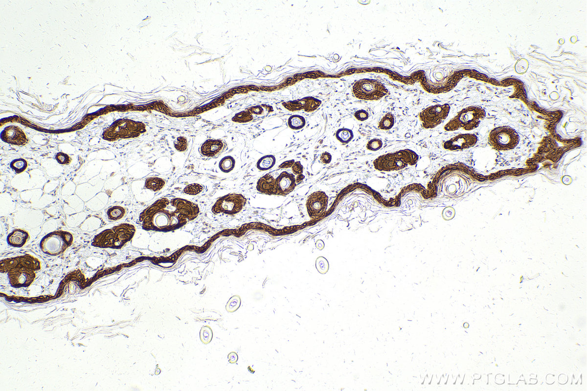 Immunohistochemical analysis of paraffin-embedded rat skin tissue slide using KHC2446 (TRIM29 IHC Kit).