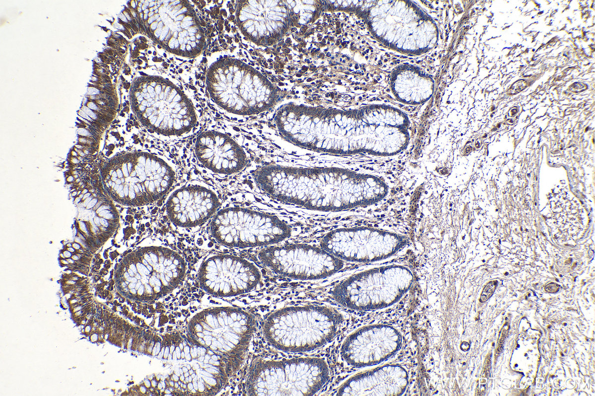 Immunohistochemical analysis of paraffin-embedded human colon tissue slide using KHC1179 (TRIM32 IHC Kit).