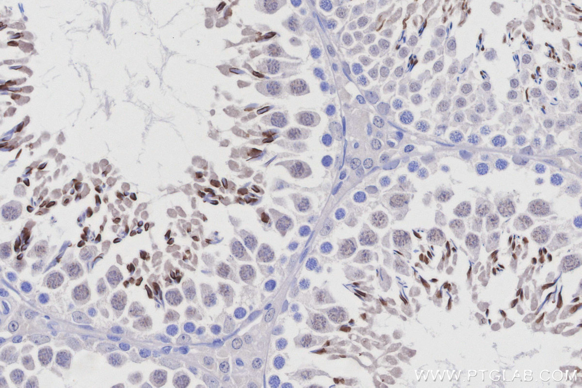 Immunohistochemical analysis of paraffin-embedded rat testis tissue slide using KHC2938 (TRIM36 IHC Kit).