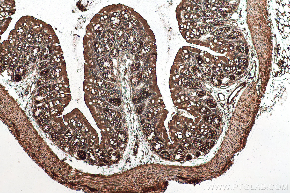 Immunohistochemical analysis of paraffin-embedded mouse colon tissue slide using KHC0966 (TRIM47 IHC Kit).