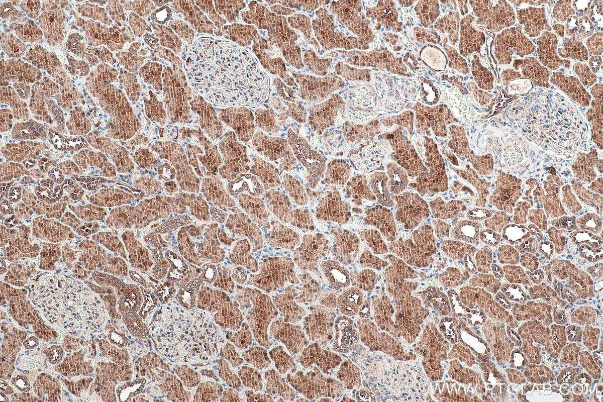 Immunohistochemical analysis of paraffin-embedded human kidney tissue slide using KHC0966 (TRIM47 IHC Kit).