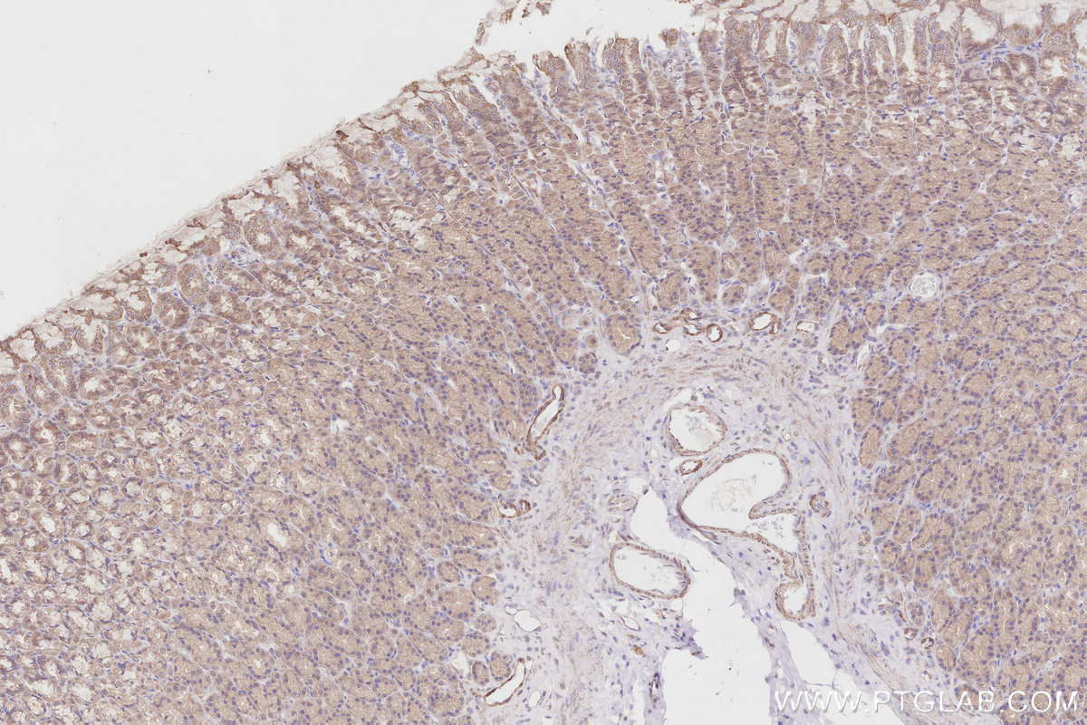 Immunohistochemical analysis of paraffin-embedded rat stomach tissue slide using KHC2860 (TRIM56 IHC Kit).