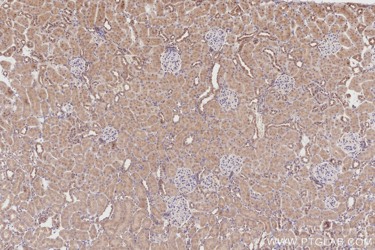 Immunohistochemical analysis of paraffin-embedded rat kidney tissue slide using KHC2860 (TRIM56 IHC Kit).