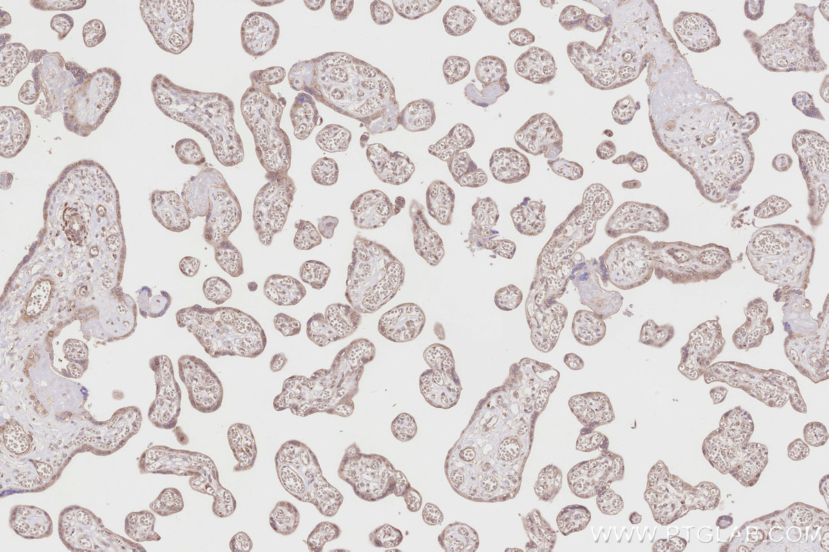 Immunohistochemical analysis of paraffin-embedded human placenta tissue slide using KHC2860 (TRIM56 IHC Kit).