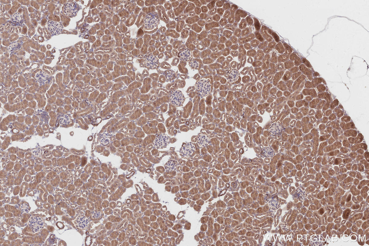Immunohistochemical analysis of paraffin-embedded mouse kidney tissue slide using KHC2860 (TRIM56 IHC Kit).
