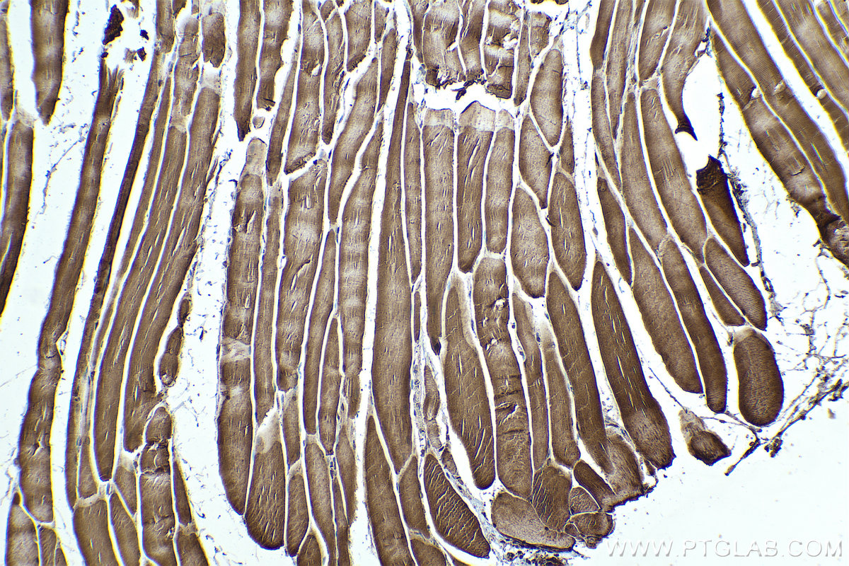 Immunohistochemical analysis of paraffin-embedded rat skeletal muscle tissue slide using KHC0330 (TRIM63 IHC Kit).