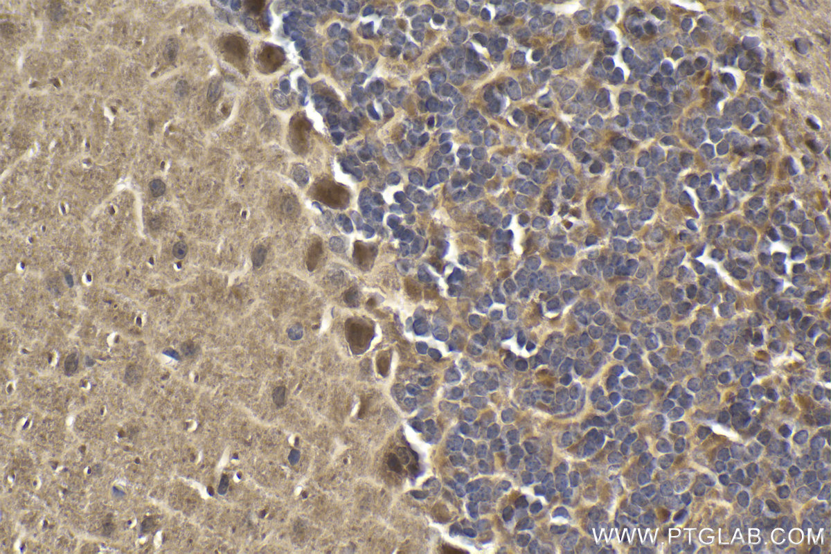 Immunohistochemical analysis of paraffin-embedded mouse cerebellum tissue slide using KHC1912 (TRIM8 IHC Kit).