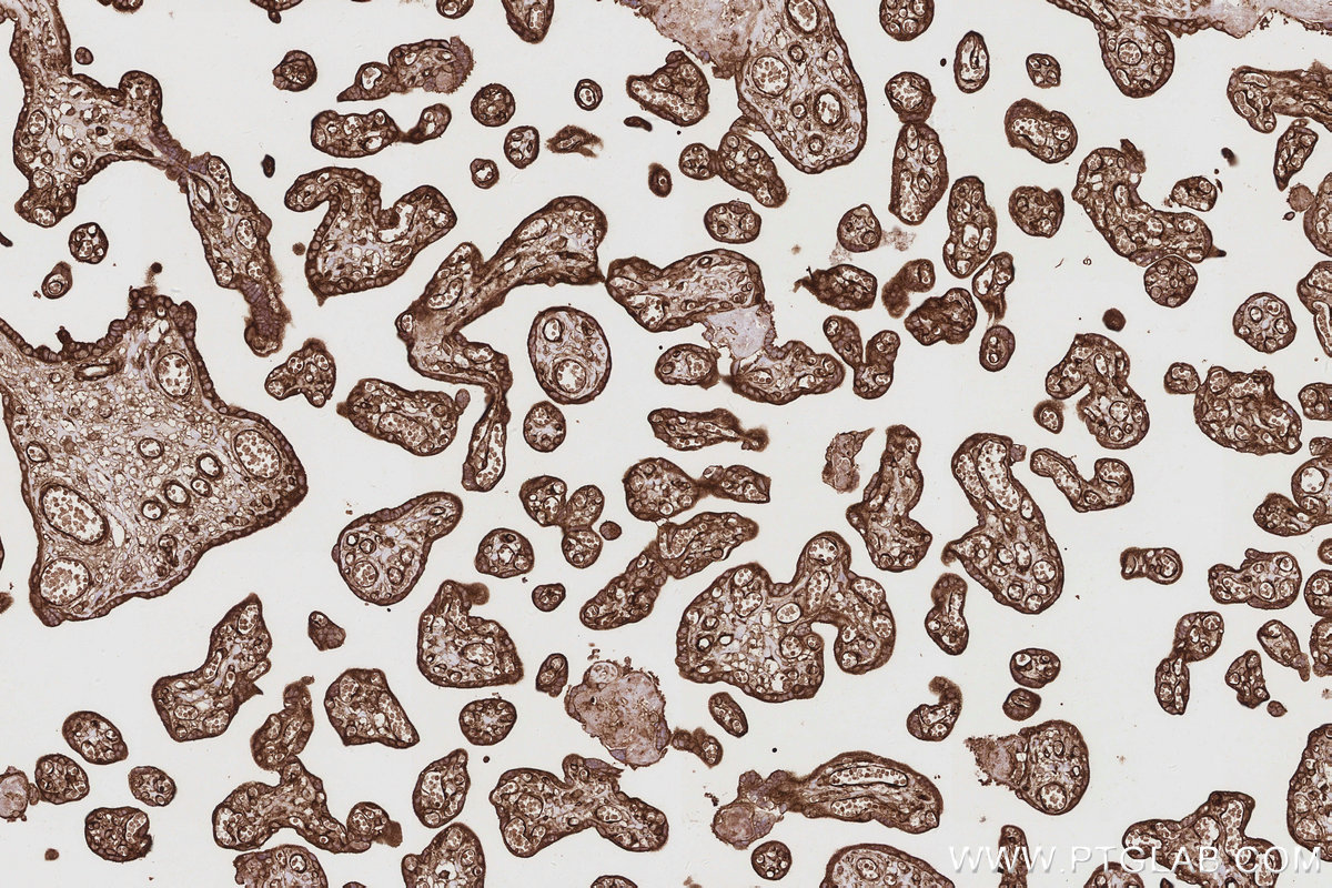 Immunohistochemical analysis of paraffin-embedded human placenta tissue slide using KHC2904 (TRIOBP IHC Kit).