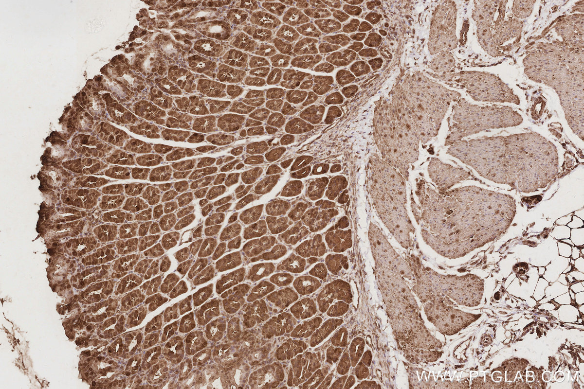 Immunohistochemical analysis of paraffin-embedded mouse stomach tissue slide using KHC2904 (TRIOBP IHC Kit).