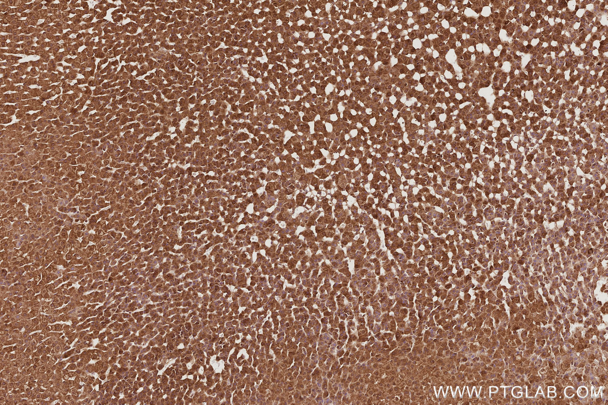 Immunohistochemical analysis of paraffin-embedded rat adrenal gland tissue slide using KHC2904 (TRIOBP IHC Kit).