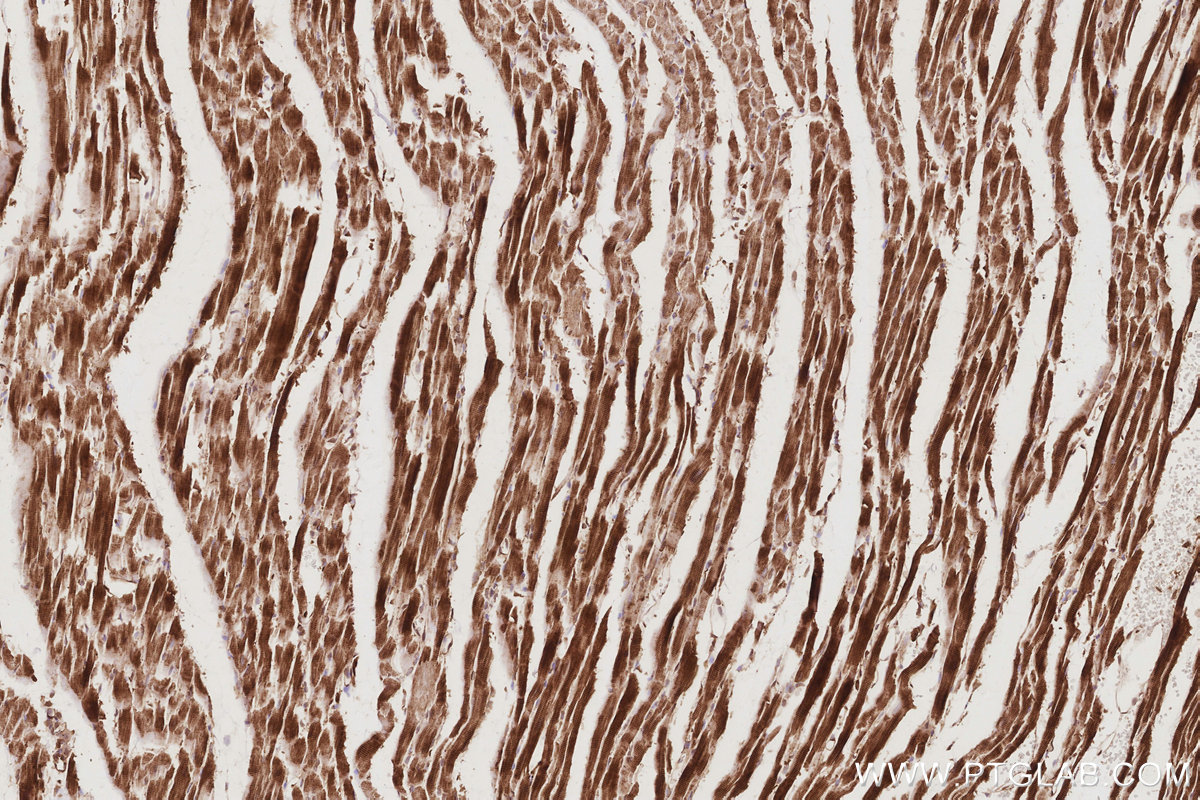 Immunohistochemical analysis of paraffin-embedded rat heart tissue slide using KHC2904 (TRIOBP IHC Kit).