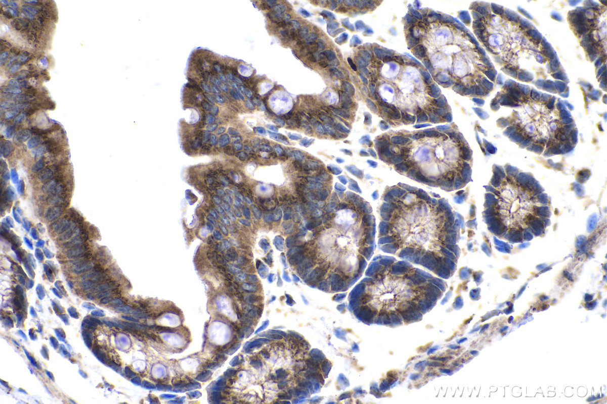 Immunohistochemical analysis of paraffin-embedded mouse colon tissue slide using KHC1382 (TRIP11 IHC Kit).