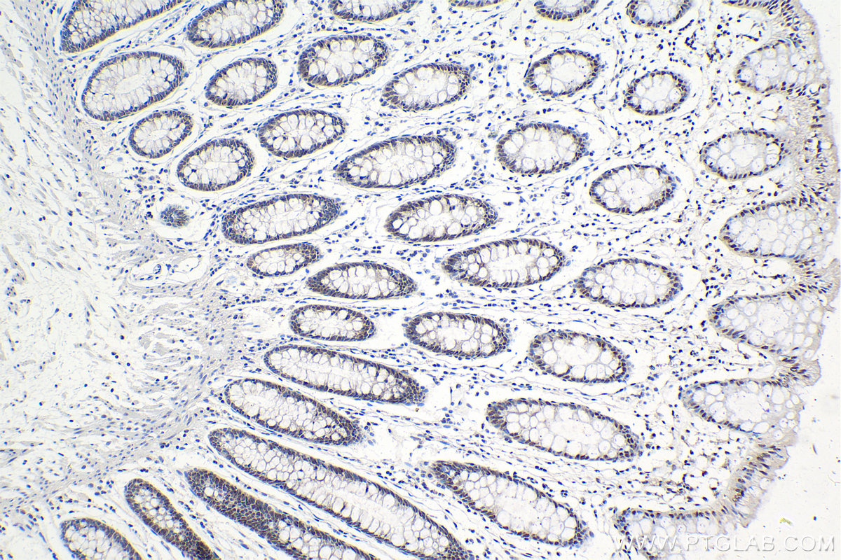 Immunohistochemical analysis of paraffin-embedded human colon tissue slide using KHC0989 (C19orf43 IHC Kit).