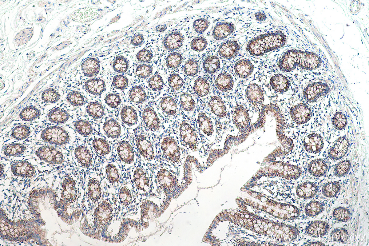 Immunohistochemical analysis of paraffin-embedded human colon tissue slide using KHC0179 (TRMT10C IHC Kit).