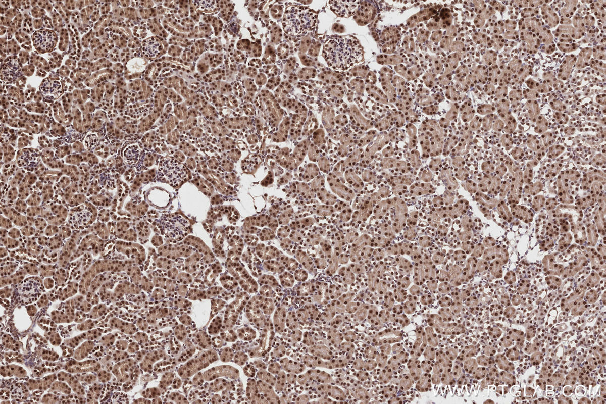 Immunohistochemical analysis of paraffin-embedded mouse kidney tissue slide using KHC2818 (TRNT1 IHC Kit).