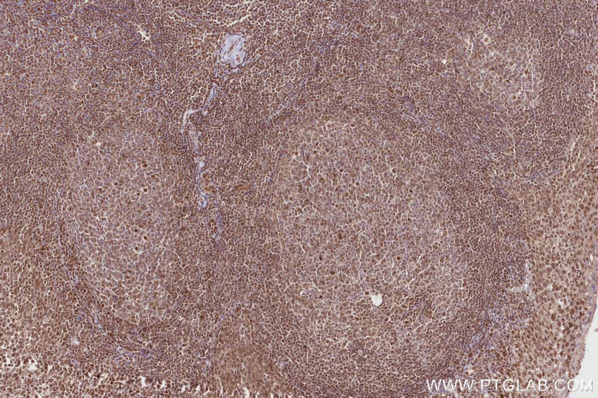 Immunohistochemical analysis of paraffin-embedded human tonsillitis tissue slide using KHC2818 (TRNT1 IHC Kit).