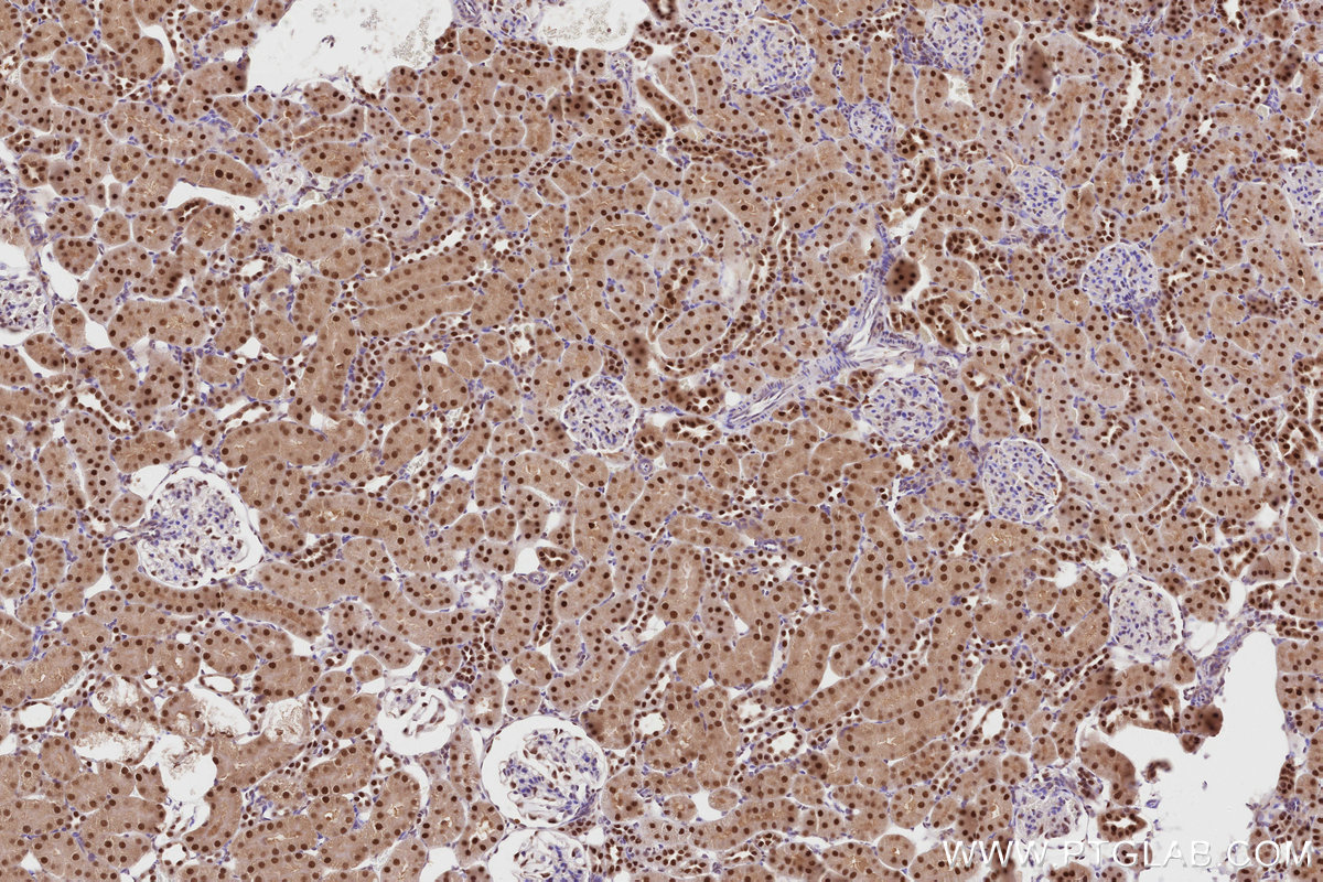 Immunohistochemical analysis of paraffin-embedded rat kidney tissue slide using KHC2818 (TRNT1 IHC Kit).