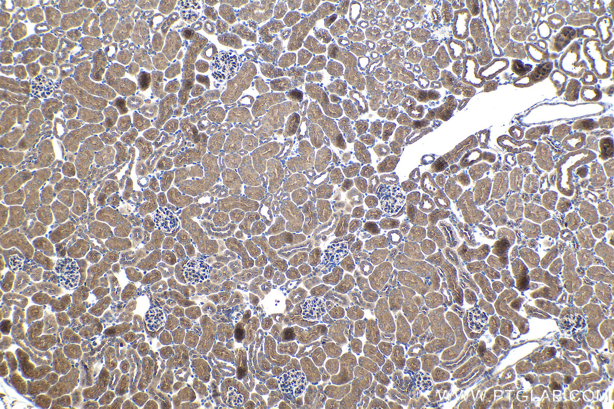 Immunohistochemical analysis of paraffin-embedded mouse kidney tissue slide using KHC1060 (TSC1 IHC Kit).