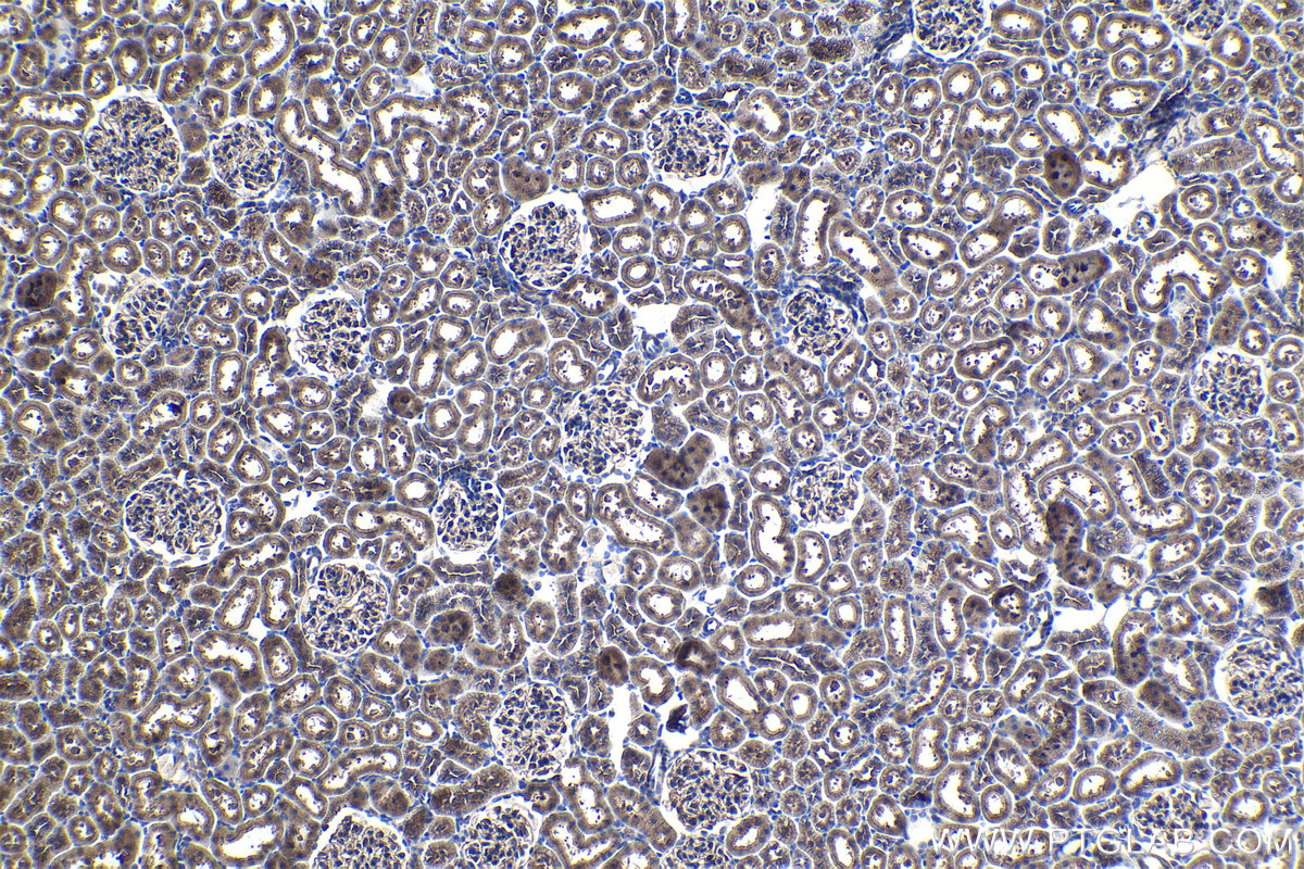 Immunohistochemical analysis of paraffin-embedded rat kidney tissue slide using KHC1060 (TSC1 IHC Kit).