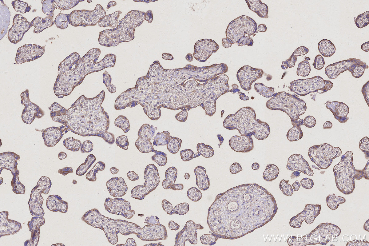 Immunohistochemical analysis of paraffin-embedded human placenta tissue slide using KHC3122 (TSC22D2 IHC Kit).