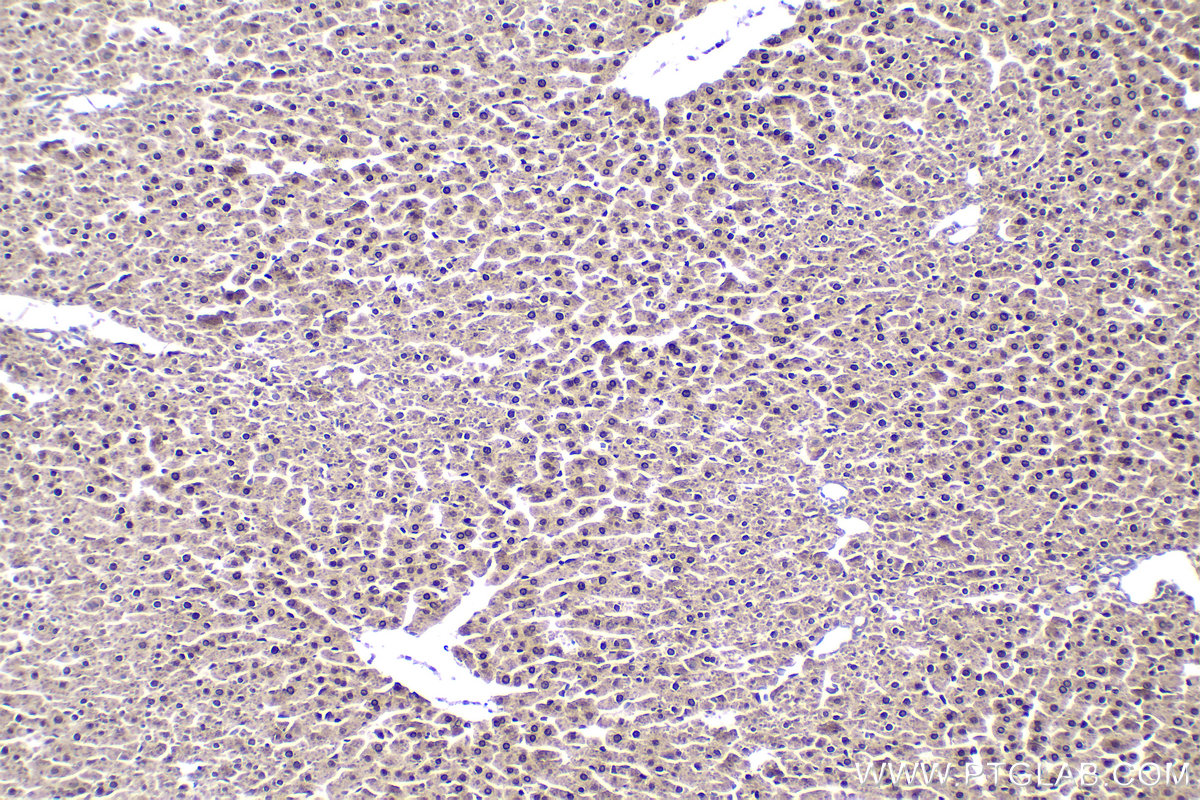 Immunohistochemical analysis of paraffin-embedded rat liver tissue slide using KHC1897 (TSG101 IHC Kit).
