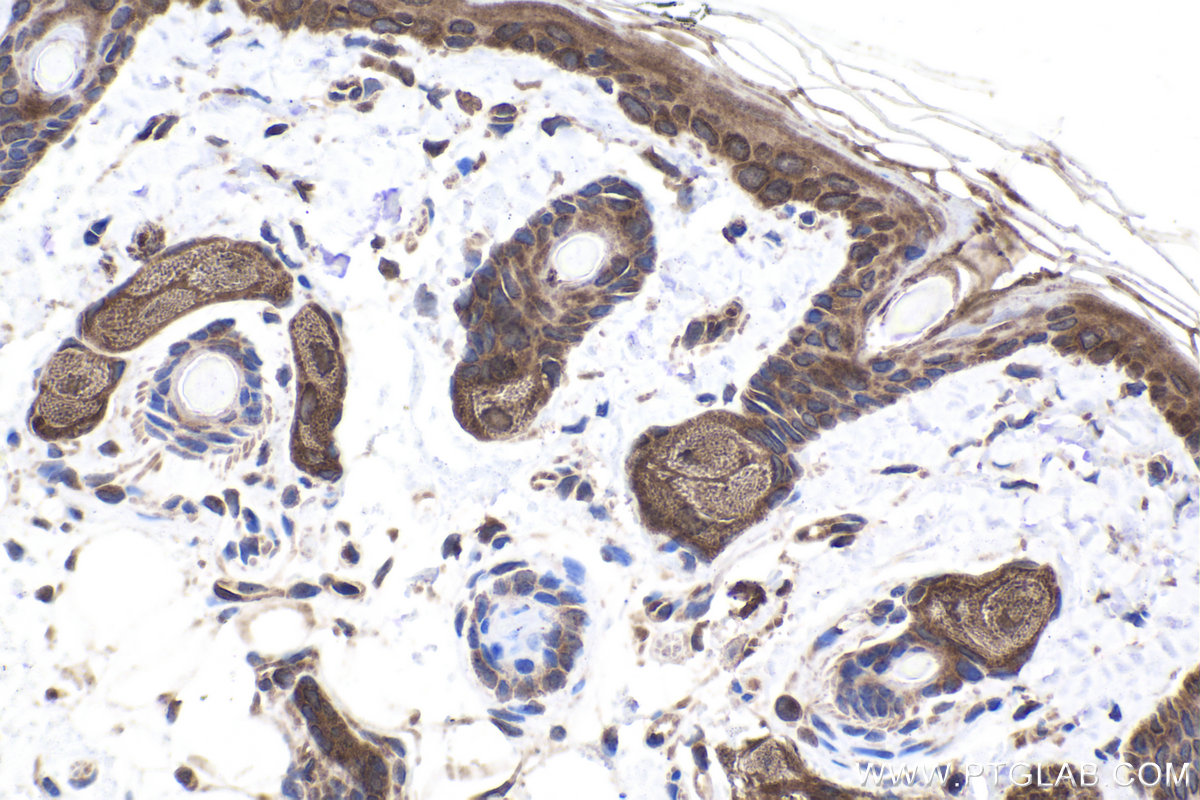 Immunohistochemical analysis of paraffin-embedded rat skin tissue slide using KHC1897 (TSG101 IHC Kit).