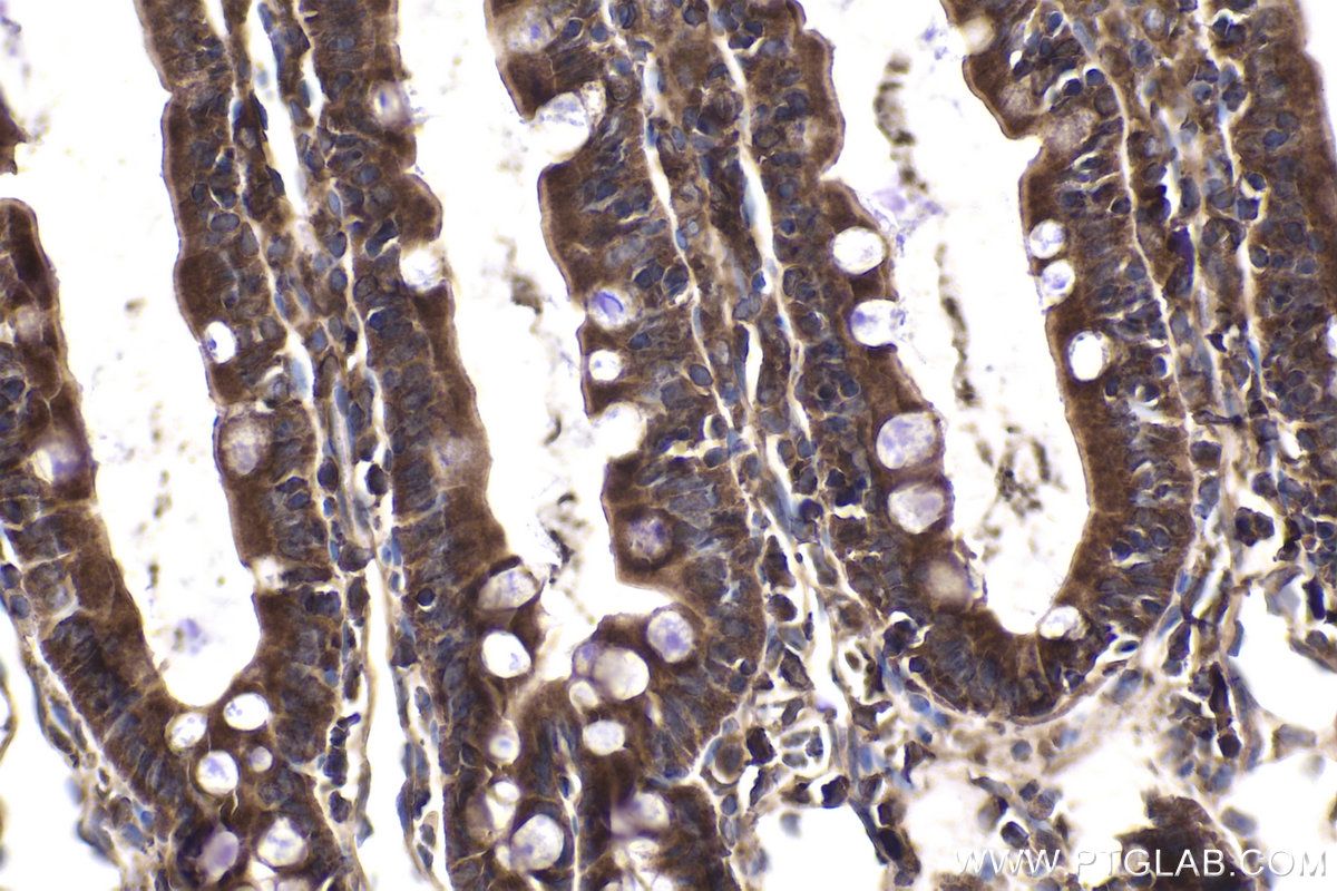 Immunohistochemical analysis of paraffin-embedded rat small intestine tissue slide using KHC1897 (TSG101 IHC Kit).