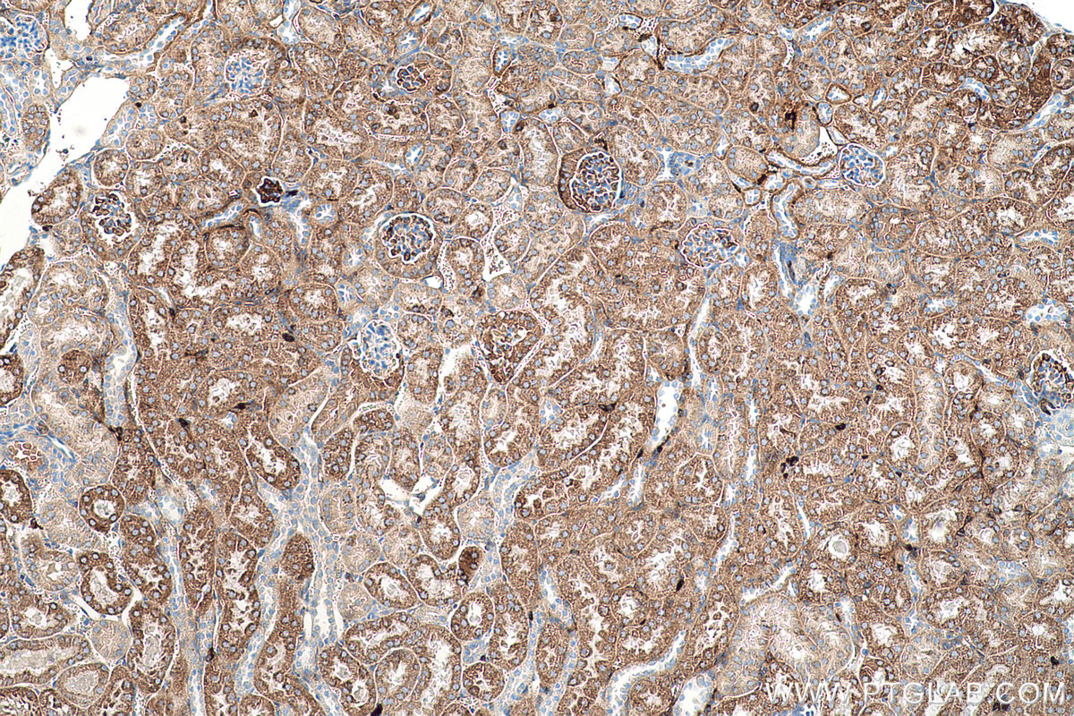 Immunohistochemical analysis of paraffin-embedded mouse kidney tissue slide using KHC0565 (TST IHC Kit).