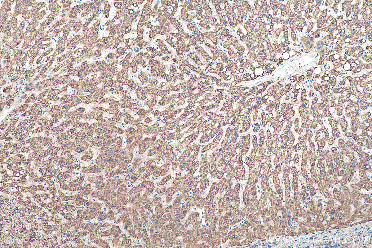 Immunohistochemical analysis of paraffin-embedded human liver tissue slide using KHC0565 (TST IHC Kit).