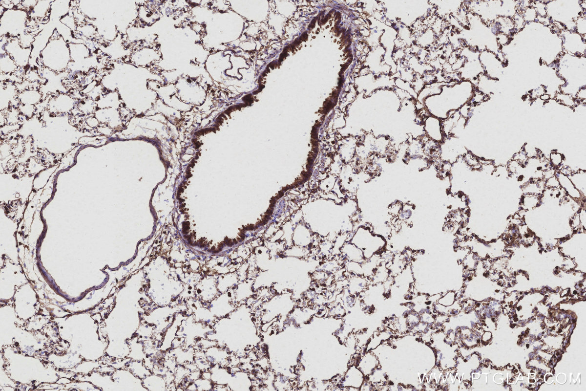 Immunohistochemical analysis of paraffin-embedded rat lung tissue slide using KHC3107 (TTL IHC Kit). Immunohistochemical analysis of paraffin-embedded rat lung tissue slide using KHC3107 (TTL IHC Kit).