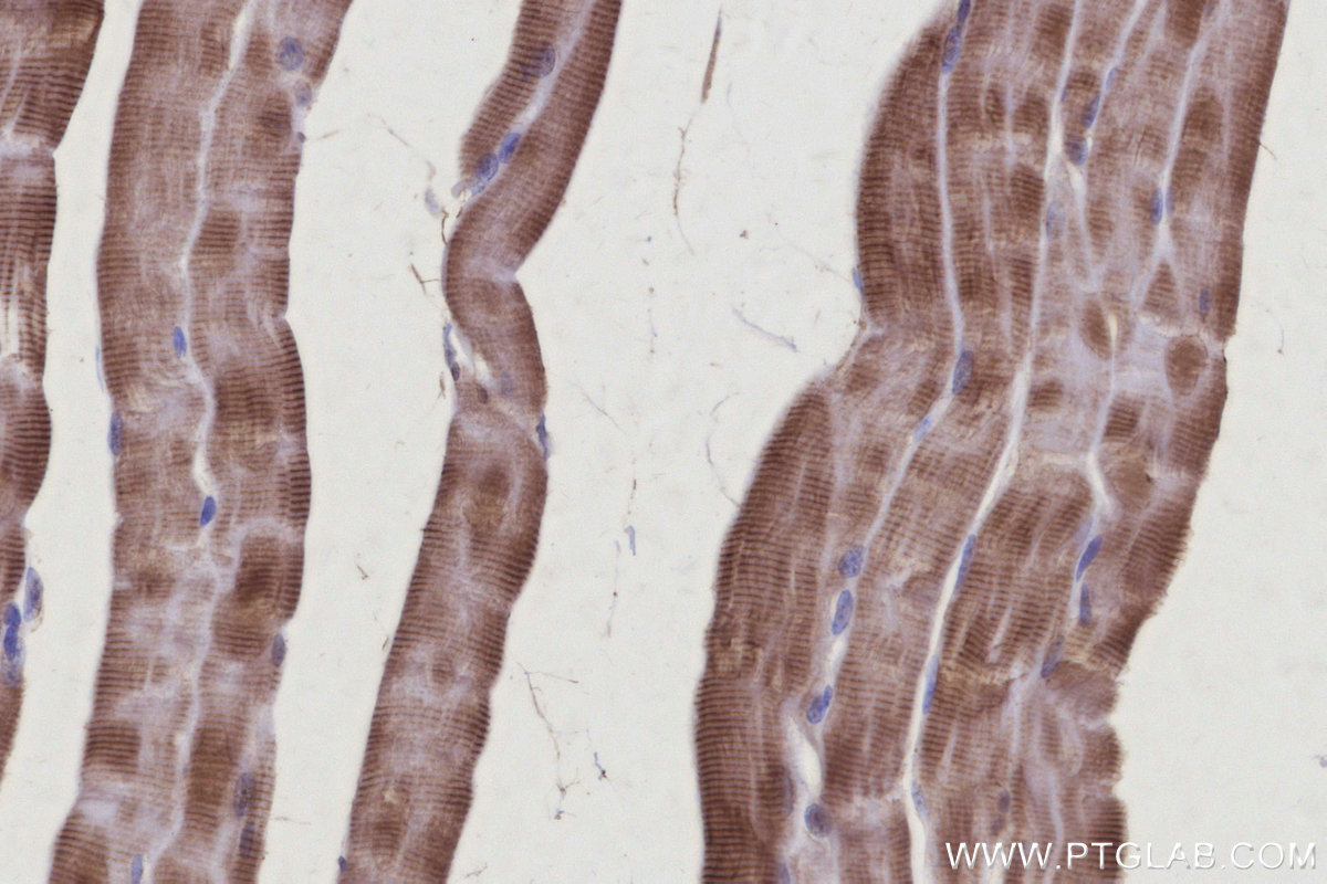 Immunohistochemical analysis of paraffin-embedded mouse skeletal muscle tissue slide using KHC3107 (TTL IHC Kit). Immunohistochemical analysis of paraffin-embedded mouse skeletal muscle tissue slide using KHC3107 (TTL IHC Kit).