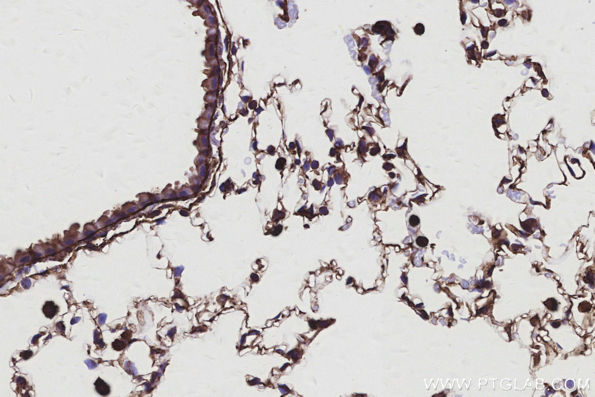 Immunohistochemical analysis of paraffin-embedded mouse lung tissue slide using KHC3107 (TTL IHC Kit). Immunohistochemical analysis of paraffin-embedded mouse lung tissue slide using KHC3107 (TTL IHC Kit).