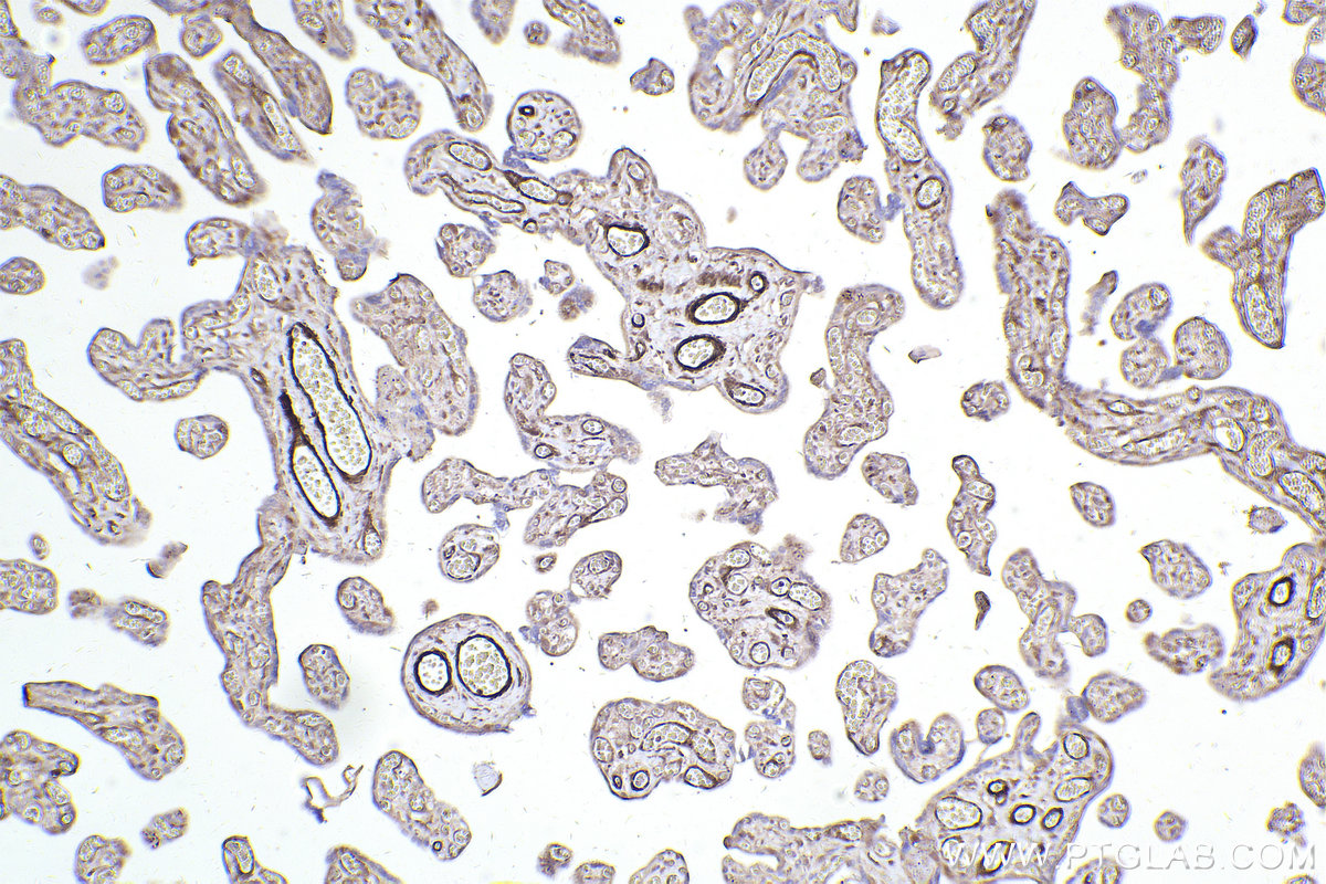 Immunohistochemical analysis of paraffin-embedded human placenta tissue slide using KHC2453 (TTLL12 IHC Kit).