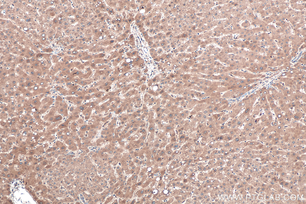 Immunohistochemical analysis of paraffin-embedded human liver tissue slide using KHC0569 (TTPA/TPP1 IHC Kit).