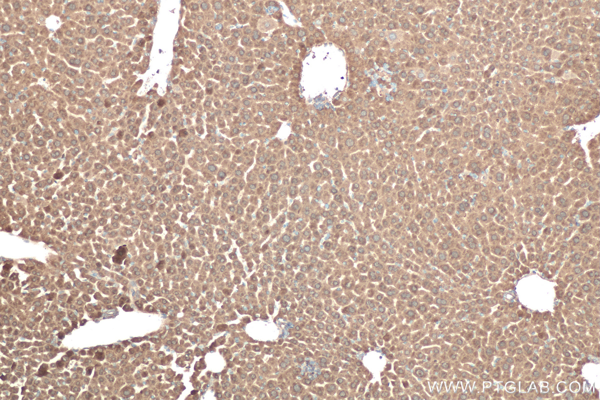 Immunohistochemical analysis of paraffin-embedded mouse liver tissue slide using KHC0569 (TTPA/TPP1 IHC Kit).