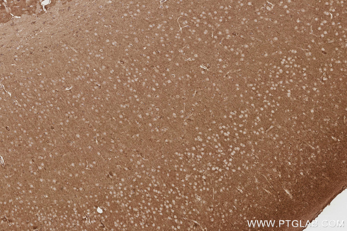 Immunohistochemical analysis of paraffin-embedded mouse brain tissue slide using KHC2909 (TTYH1 IHC Kit).