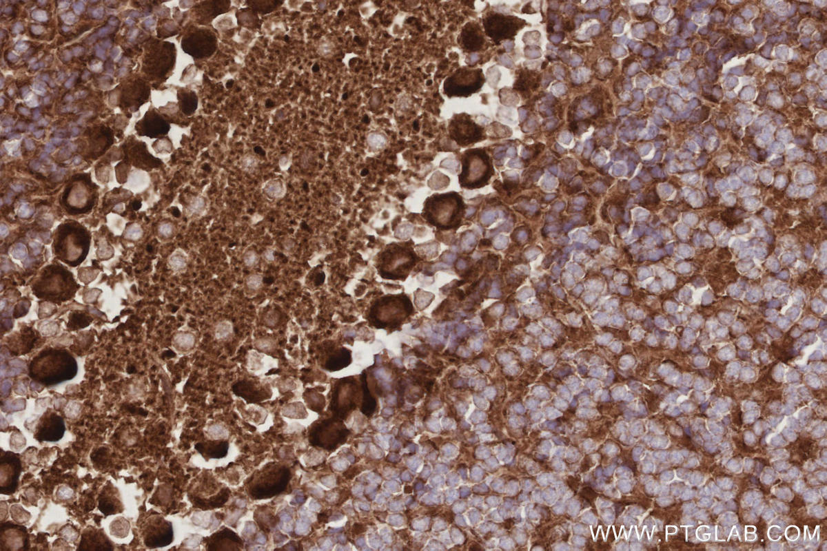 Immunohistochemical analysis of paraffin-embedded mouse cerebellum tissue slide using KHC2909 (TTYH1 IHC Kit).