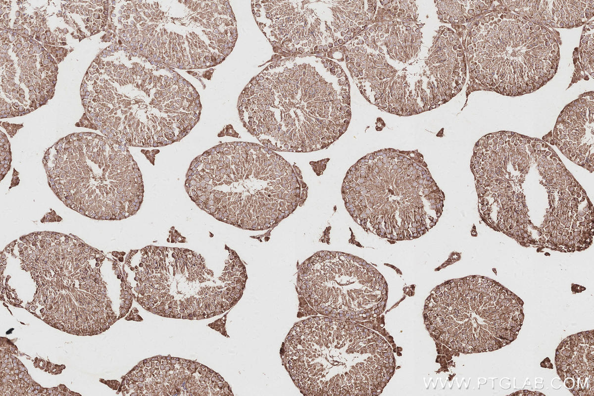 Immunohistochemical analysis of paraffin-embedded mouse testis tissue slide using KHC2909 (TTYH1 IHC Kit).