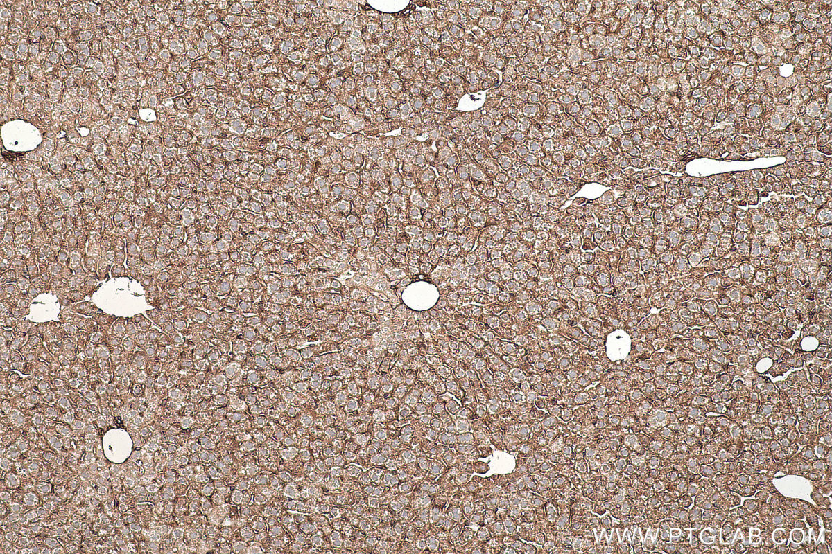 Immunohistochemical analysis of paraffin-embedded mouse liver tissue slide using KHC0468 (Alpha Tubulin IHC Kit).