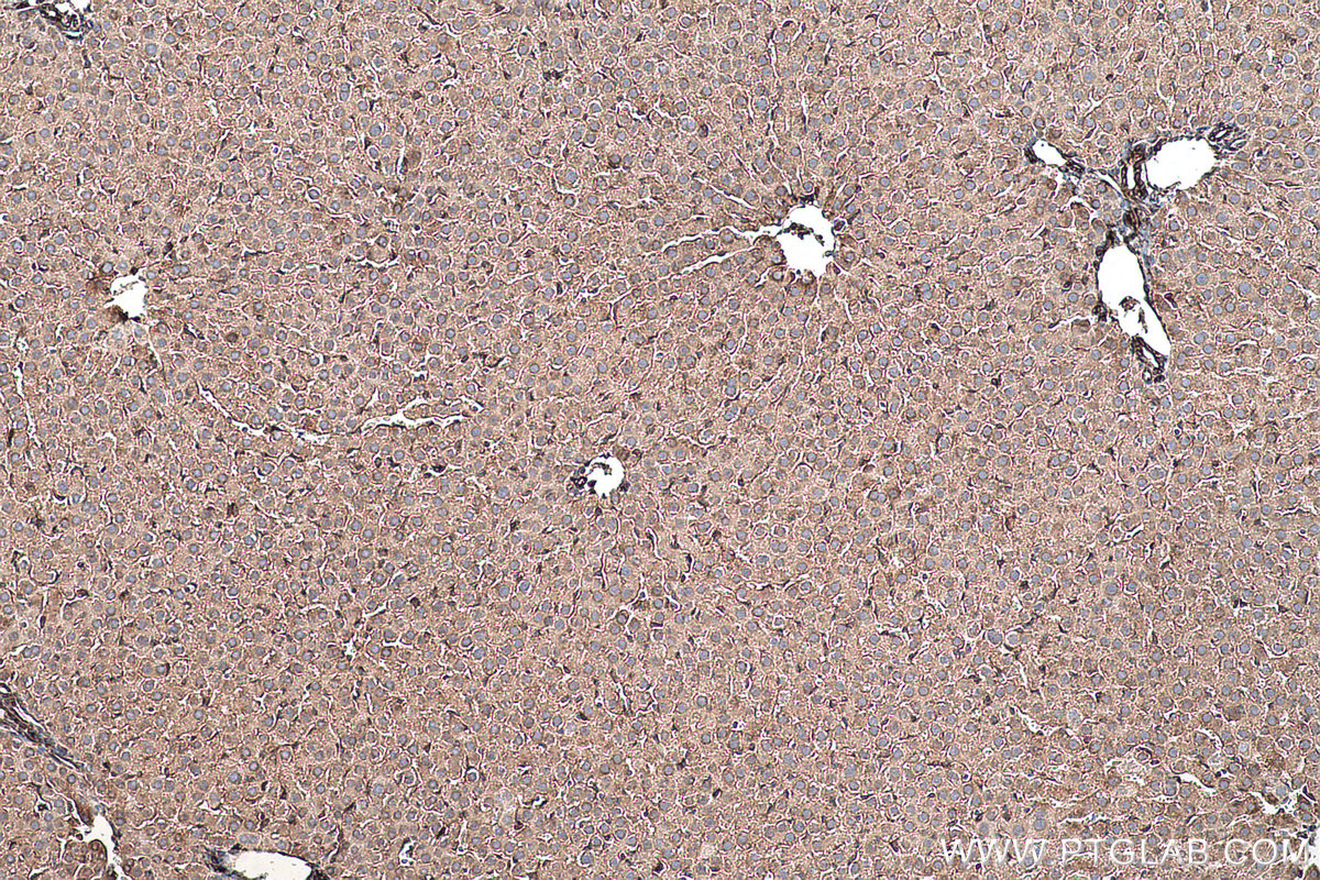 Immunohistochemical analysis of paraffin-embedded rat liver tissue slide using KHC0468 (Alpha Tubulin IHC Kit).