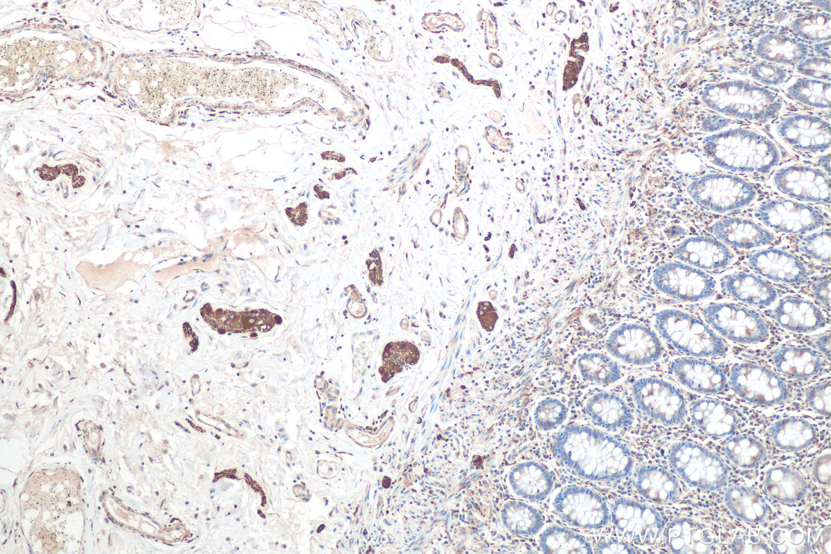 Immunohistochemical analysis of paraffin-embedded human colon tissue slide using KHC0825 (TUBB2B IHC Kit).