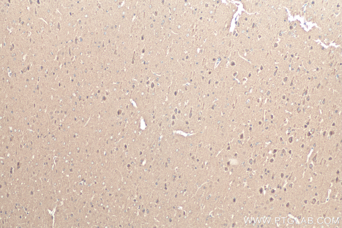 Immunohistochemical analysis of paraffin-embedded rat brain tissue slide using KHC0825 (TUBB2B IHC Kit).