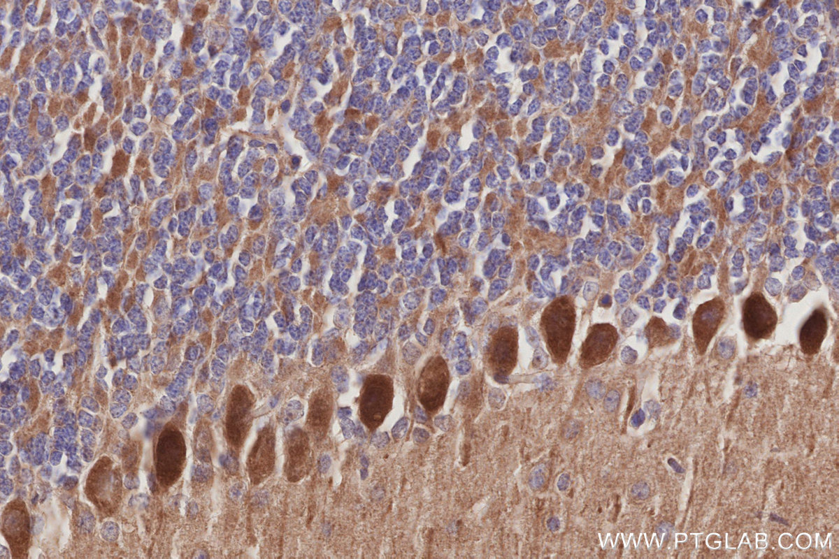 Immunohistochemical analysis of paraffin-embedded mouse cerebellum tissue slide using KHC3018 (TUBD1 IHC Kit). Immunohistochemical analysis of paraffin-embedded mouse cerebellum tissue slide using KHC3018 (TUBD1 IHC Kit).