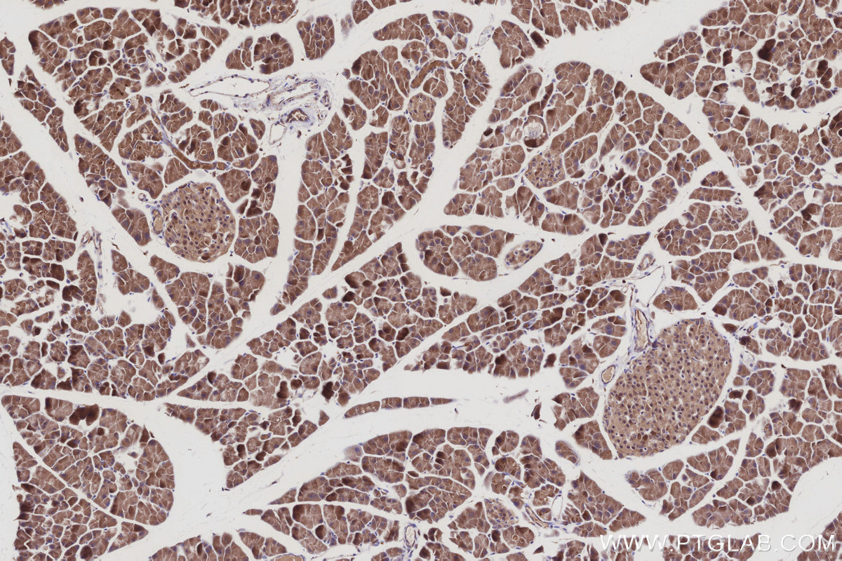 Immunohistochemical analysis of paraffin-embedded mouse pancreas tissue slide using KHC3018 (TUBD1 IHC Kit). Immunohistochemical analysis of paraffin-embedded mouse pancreas tissue slide using KHC3018 (TUBD1 IHC Kit).